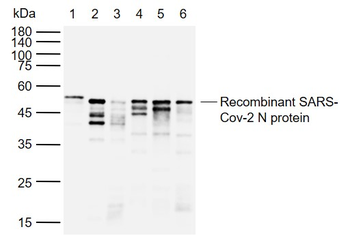 SARS-CoV-2 (2019-nCoV) Nucleocapsid Mouse Monoclonal Antibody