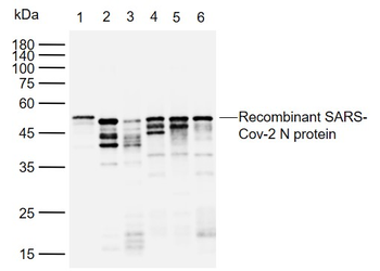 SARS-CoV-2 (2019-nCoV) Nucleocapsid Mouse Monoclonal Antibody