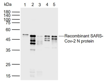 SARS-CoV-2 (2019-nCoV) Nucleocapsid Mouse Monoclonal Antibody