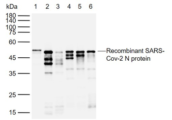 SARS-CoV-2 (2019-nCoV) Nucleocapsid Mouse Monoclonal Antibody