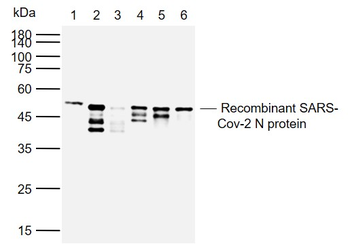 SARS-CoV-2 (2019-nCoV) Nucleocapsid Mouse Monoclonal Antibody