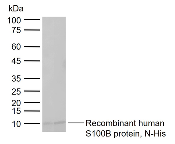 Human S100B Mouse Monoclonal Antibody