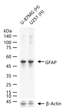 GFAP Rabbit Polyclonal Antibody