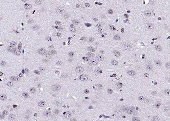 AEBP1 Rabbit Polyclonal Antibody