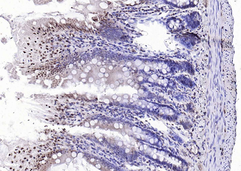 AEBP1 Rabbit Polyclonal Antibody