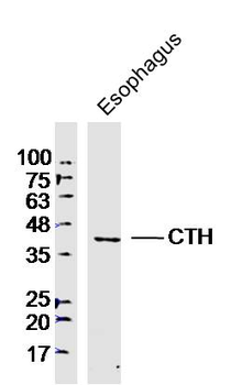 CTH Rabbit Polyclonal Antibody