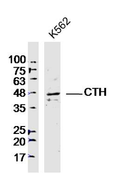 CTH Rabbit Polyclonal Antibody