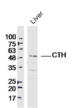 CTH Rabbit Polyclonal Antibody