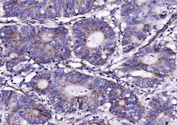 S100A10 Rabbit Polyclonal Antibody