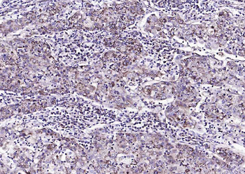 S100A10 Rabbit Polyclonal Antibody