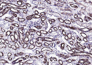 S100A10 Rabbit Polyclonal Antibody