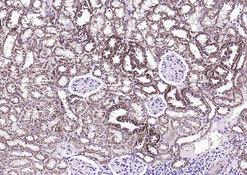 S100A10 Rabbit Polyclonal Antibody