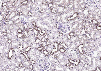 S100A10 Rabbit Polyclonal Antibody