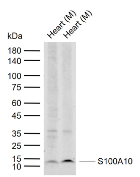 S100A10 Rabbit Polyclonal Antibody
