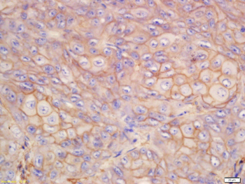 S100A10 Rabbit Polyclonal Antibody