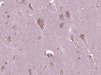 CD8 Rabbit Polyclonal Antibody