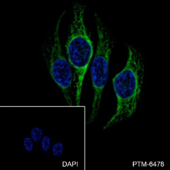 Heme Oxygenase 1 Recombinant Rabbit Monoclonal Antibody