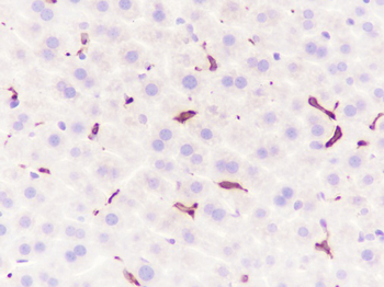 Heme Oxygenase 1 Recombinant Rabbit Monoclonal Antibody