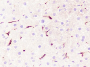 Heme Oxygenase 1 Recombinant Rabbit Monoclonal Antibody