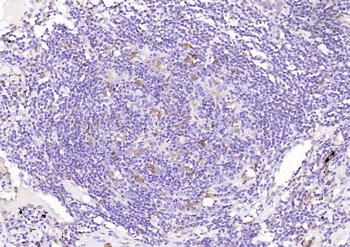 Heme Oxygenase 1 Recombinant Rabbit Monoclonal Antibody