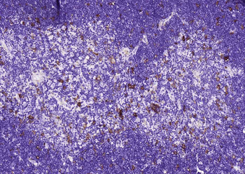 Heme Oxygenase 1 Recombinant Rabbit Monoclonal Antibody