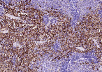 Heme Oxygenase 1 Recombinant Rabbit Monoclonal Antibody