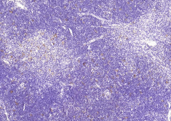 Heme Oxygenase 1 Recombinant Rabbit Monoclonal Antibody