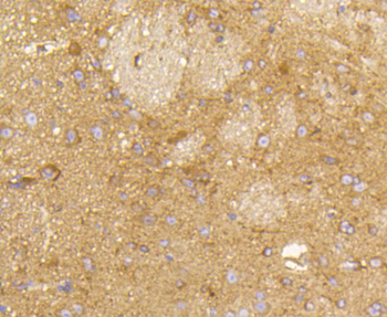 RAB5A Recombinant Rabbit Monoclonal Antibody