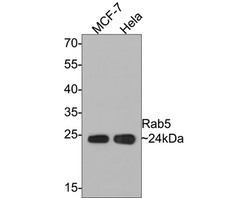RAB5A Recombinant Rabbit Monoclonal Antibody