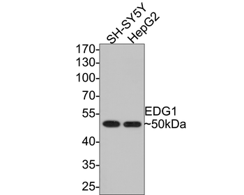 EDG1 Recombinant Rabbit Monoclonal Antibody