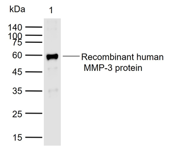MMP3 Mouse Monoclonal Antibody