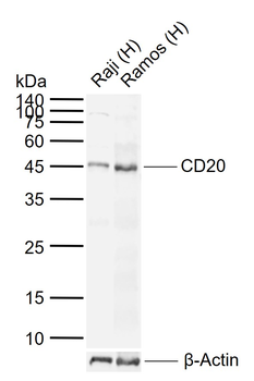 CD20 Rabbit Polyclonal Antibody