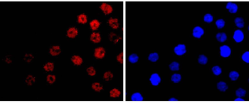 CDX2 Recombinant Rabbit Monoclonal Antibody