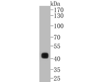 CDX2 Recombinant Rabbit Monoclonal Antibody