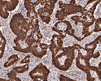 CDX2 Recombinant Rabbit Monoclonal Antibody