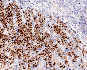 CDX2 Recombinant Rabbit Monoclonal Antibody