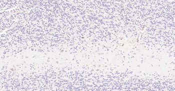 CD11b Recombinant Rabbit Monoclonal Antibody
