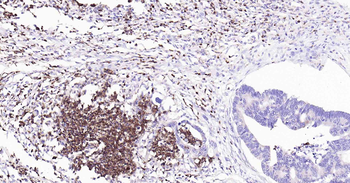 CD11b Recombinant Rabbit Monoclonal Antibody