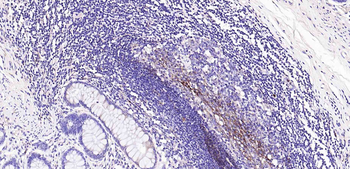 CD11b Recombinant Rabbit Monoclonal Antibody