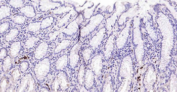 CD11b Recombinant Rabbit Monoclonal Antibody