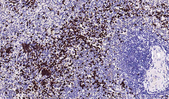 CD11b Recombinant Rabbit Monoclonal Antibody