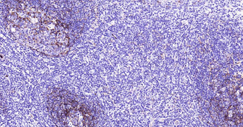 CD11b Recombinant Rabbit Monoclonal Antibody