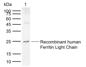 Ferritin Light Chain Mouse Monoclonal Antibody