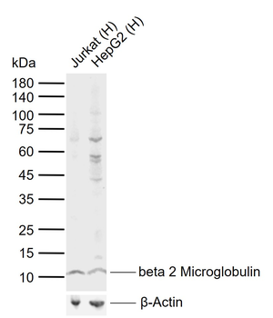 Beta 2 Microglobulin Rabbit Polyclonal Antibody