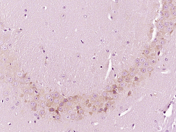 MTCH1 Rabbit Polyclonal Antibody