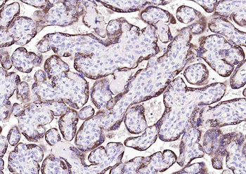 Human HCG-α Mouse Monoclonal Antibody