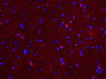 MUL1 Rabbit Polyclonal Antibody