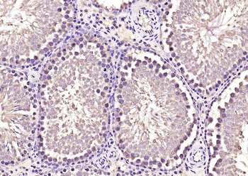 PACRG Rabbit Polyclonal Antibody