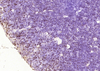 IKZF1 Rabbit Polyclonal Antibody