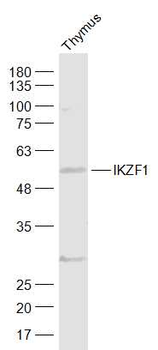 IKZF1 Rabbit Polyclonal Antibody